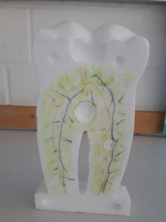 Foto eines Zahnmodells